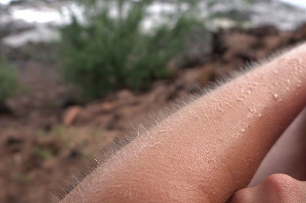 Tubuh Merinding Sebagai Respons Alami Manusia